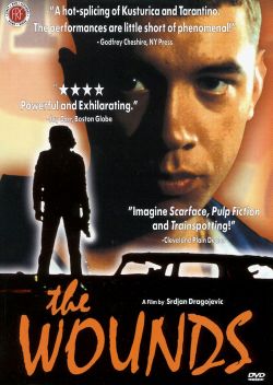 The Wounds