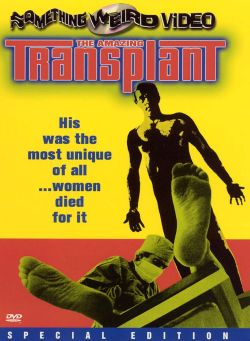 The Amazing Transplant