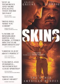 Skins