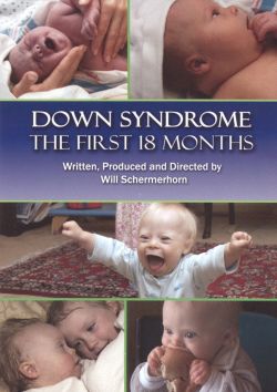 Down Syndrome: The First 18 Months