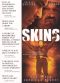 Skins
