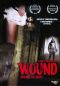 Wound