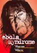 Ebola Syndrome