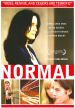 Normal