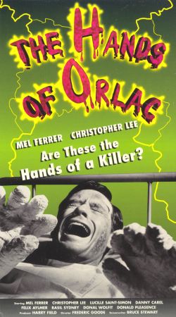 Les Mains D'Orlac