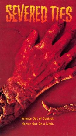 Severed Ties