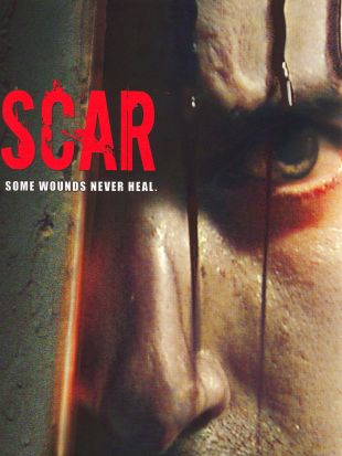 Scar