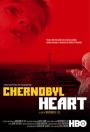 Chernobyl Heart