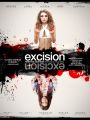 Excision